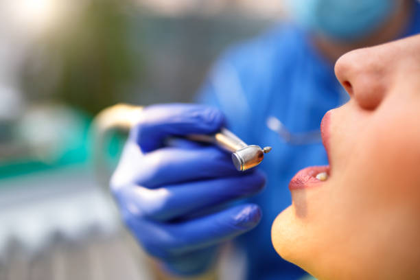 Dental Bonding in Havre, MT